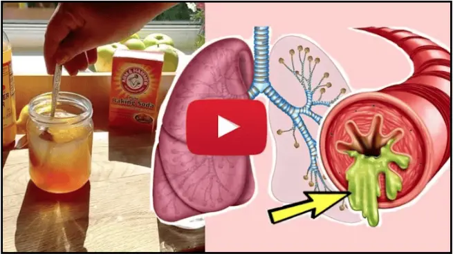 COPD Natural Treatment and Lung Detox Mucus Melting